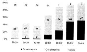 Рис. 13.6. Частота остеопороза, остеопений в зависимости от возраста у женского населения Украины