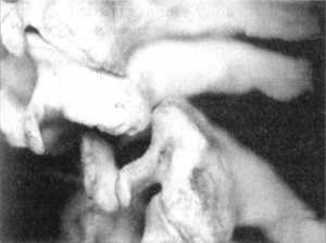 Рис. 2.12.10. Наклон головы влево. Левый сустав. Вид сбоку