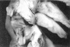 Рис. 2.12.18. Наклон головы. Левый сустав. Вид сбоку