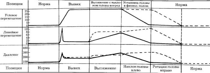 Рис. 2.16. Сравнительная характеристика вправлений одностороннего сцепившегося вывиха справа по методу Рише-Гютера и предлагаемым способом