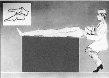 Рис. 2.19.3. Сила вытяжения продолжает оставаться максимальной. Хирург и больной находятся в исходной позиции