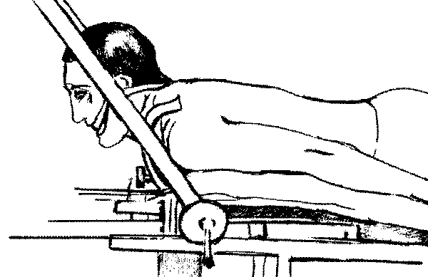 Рис. 2.24. Шейный отдел позвоночника больного в положении разгибания. Сила вытяжения минимальна
